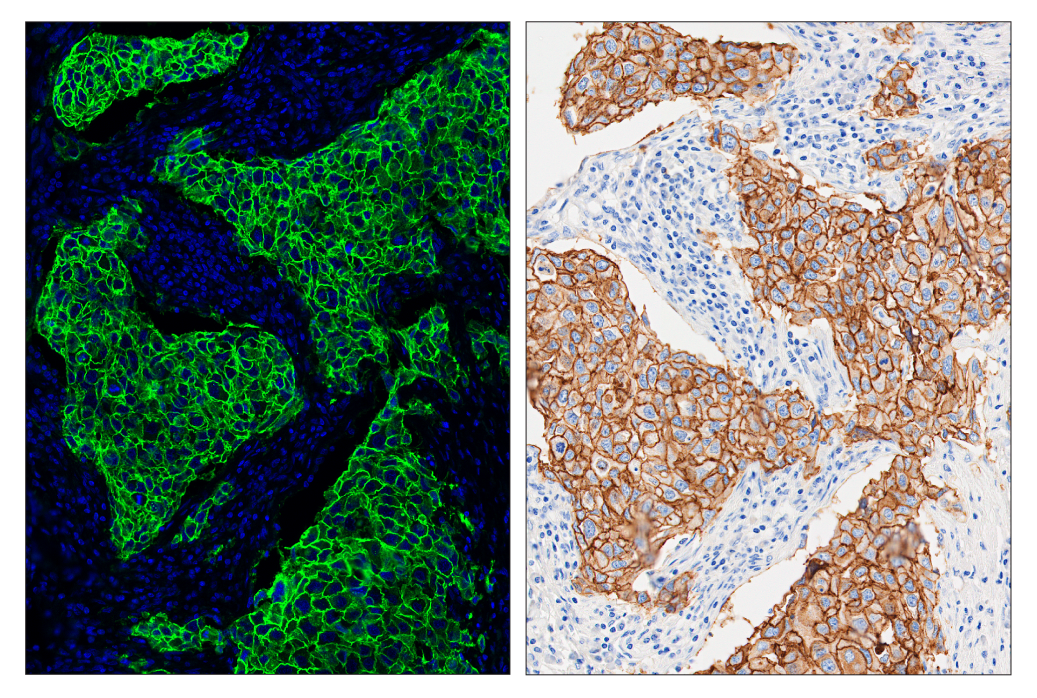 Immunohistochemistry Image 6: HER2/ErbB2 (D8F12) & CO-0059-488 SignalStar™ Oligo-Antibody Pair