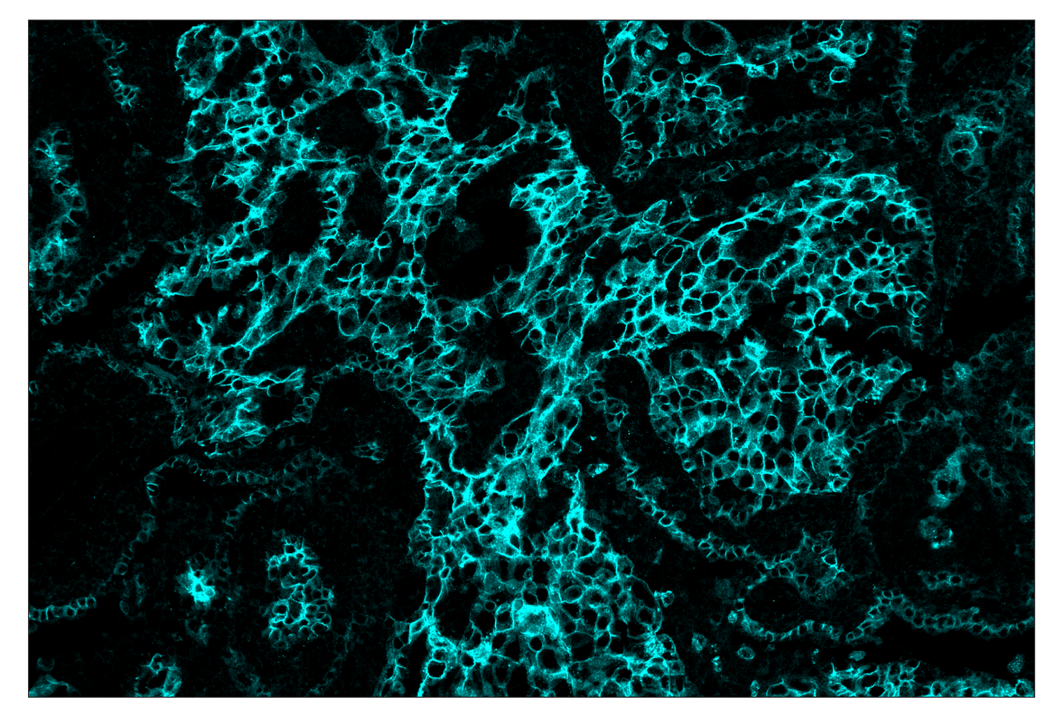 Immunohistochemistry Image 5: HER2/ErbB2 (D8F12) & CO-0059-488 SignalStar™ Oligo-Antibody Pair