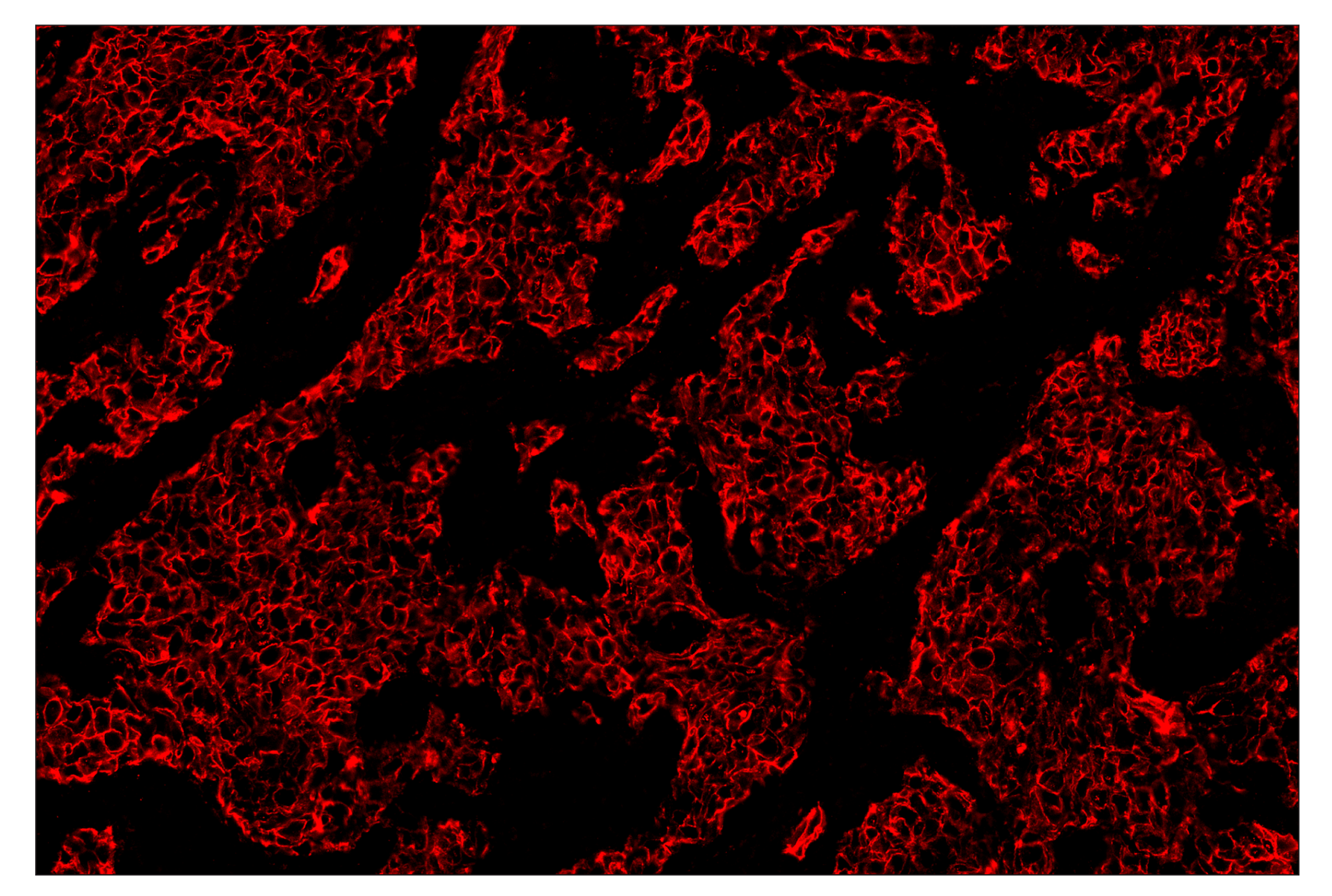 Immunohistochemistry Image 4: HER2/ErbB2 (D8F12) & CO-0059-488 SignalStar™ Oligo-Antibody Pair
