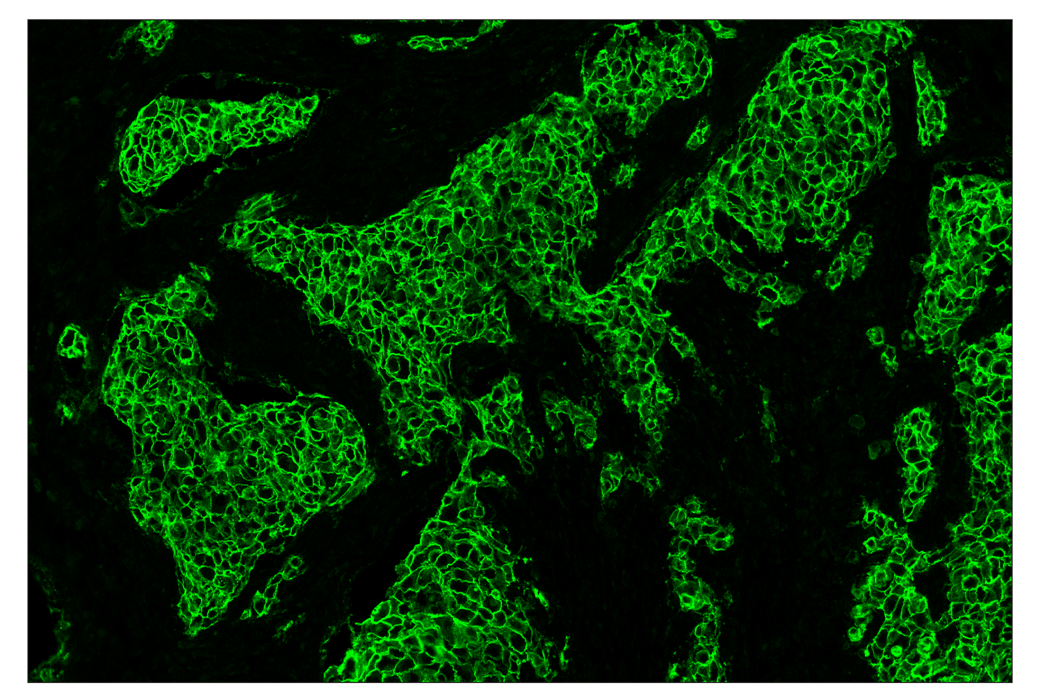 Immunohistochemistry Image 2: HER2/ErbB2 (D8F12) & CO-0059-488 SignalStar™ Oligo-Antibody Pair