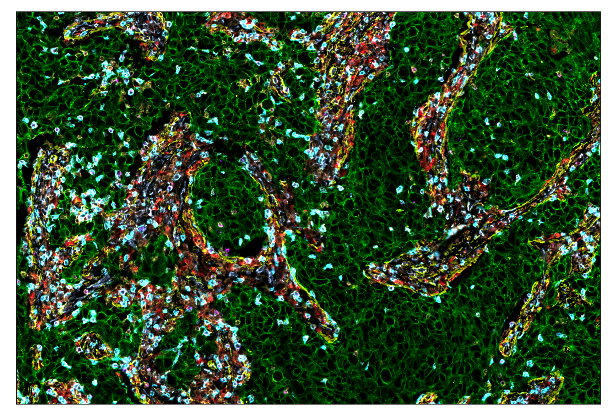 Immunohistochemistry Image 1: HER2/ErbB2 (D8F12) & CO-0059-488 SignalStar™ Oligo-Antibody Pair