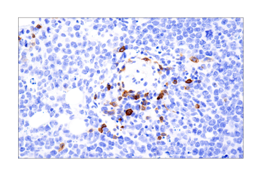 Immunohistochemistry Image 3: IL-2Rα/CD25 (E9W2J) XP® Rabbit mAb