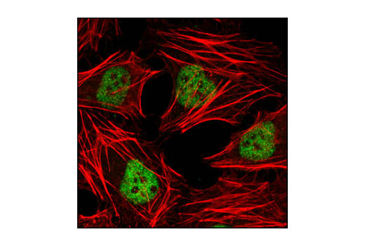 Immunofluorescence Image 1: HDAC3 (7G6C5) Mouse mAb