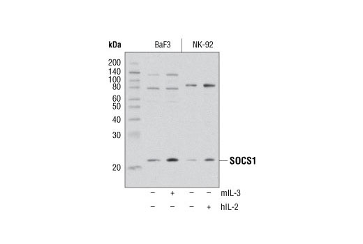 Image 3: Jak/Stat Pathway Inhibitors Antibody Sampler Kit