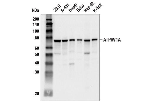 Western Blotting Image 1: ATP6V1A (E5N9E) Rabbit mAb