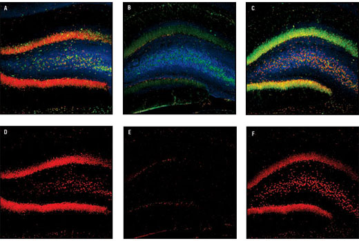 Immunofluorescence Image 1: Phospho-CREB (Ser133) (87G3) Rabbit mAb (BSA and Azide Free)