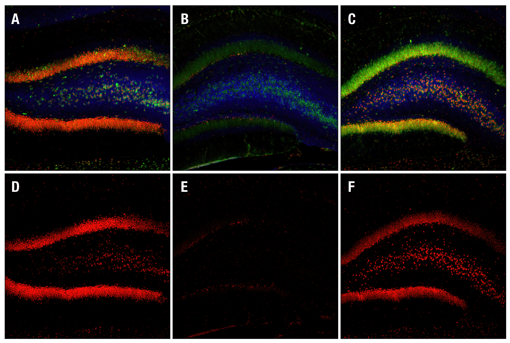 Immunofluorescence Image 1: Phospho-CREB (Ser133) (87G3) Rabbit mAb (BSA and Azide Free)