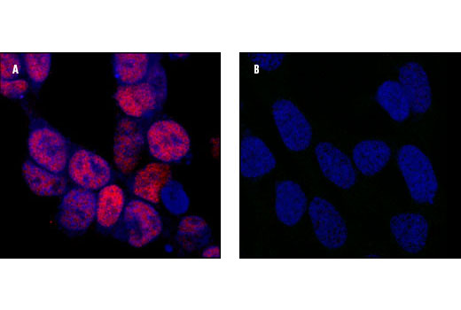 Immunofluorescence Image 2: Phospho-CREB (Ser133) (87G3) Rabbit mAb (BSA and Azide Free)