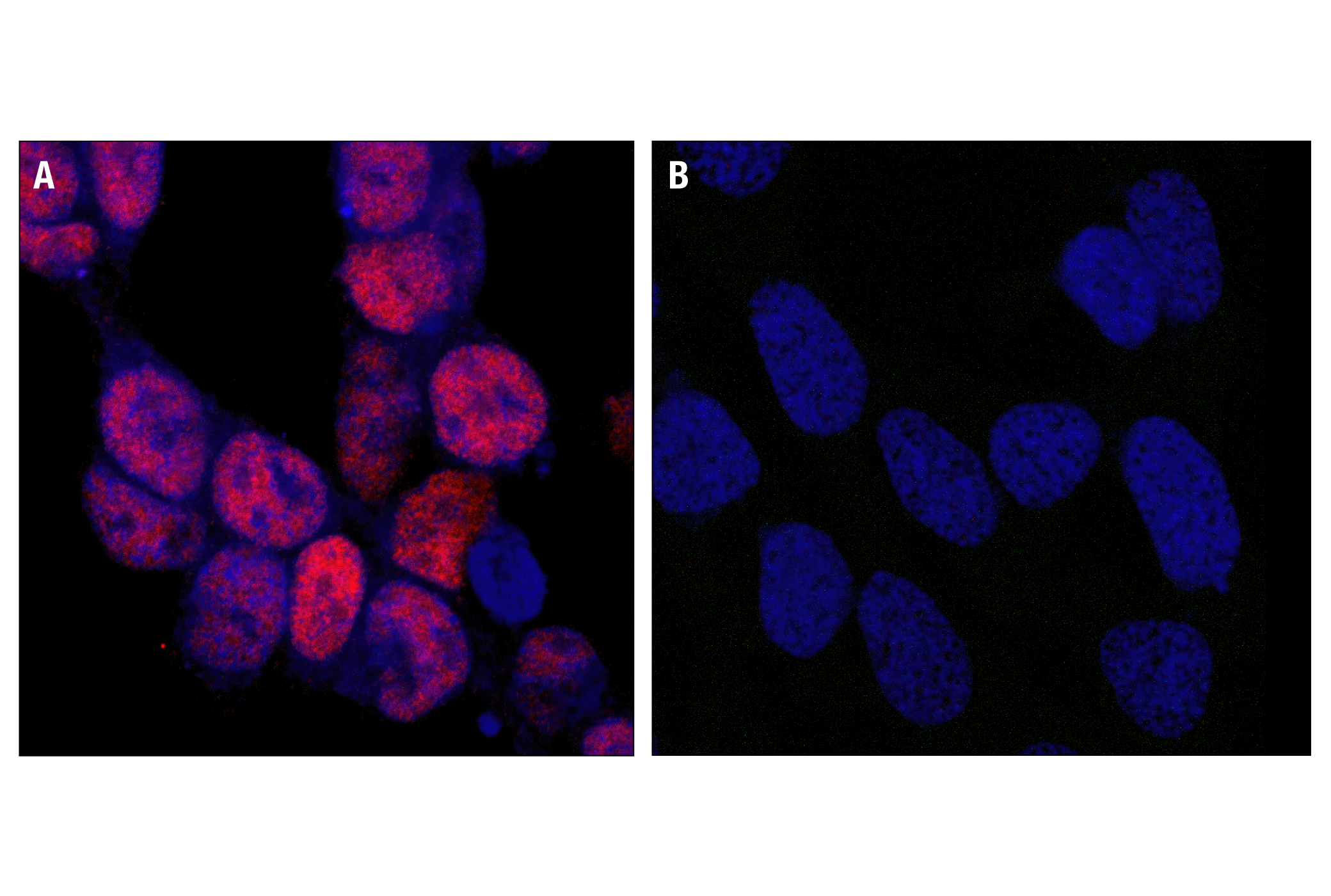 Immunofluorescence Image 2: Phospho-CREB (Ser133) (87G3) Rabbit mAb (BSA and Azide Free)
