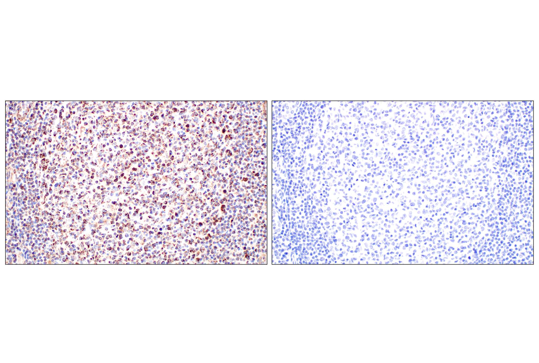 Immunohistochemistry Image 13: GOT2 (F4P3R) Rabbit mAb