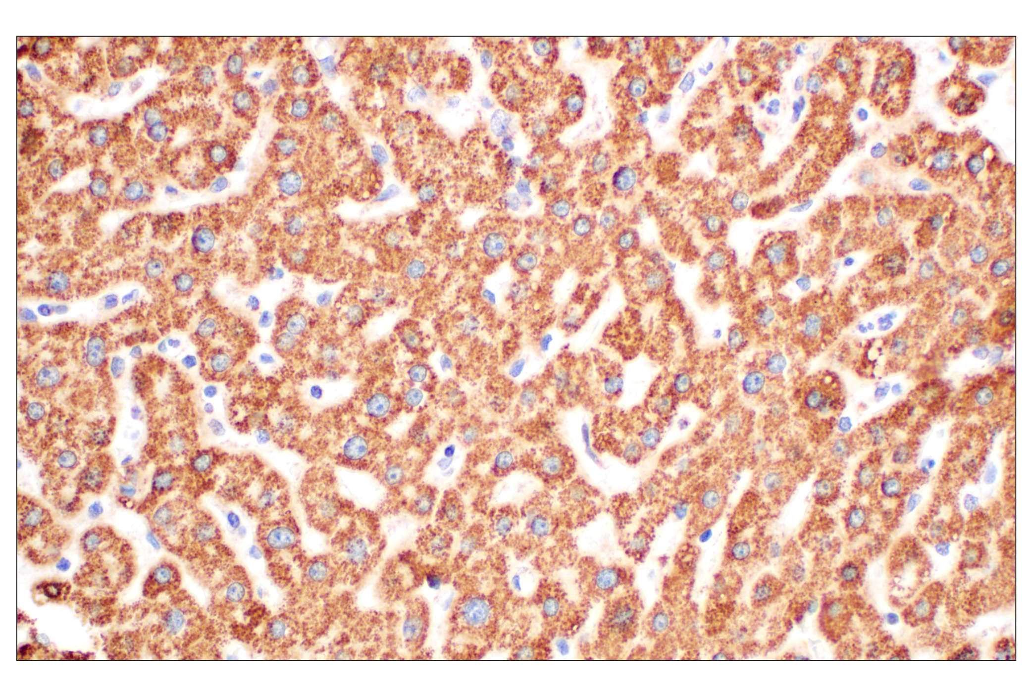 Immunohistochemistry Image 3: GOT2 (F4P3R) Rabbit mAb