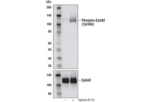 Western Blotting Image 1: Phospho-EphA2 (Tyr594) Antibody