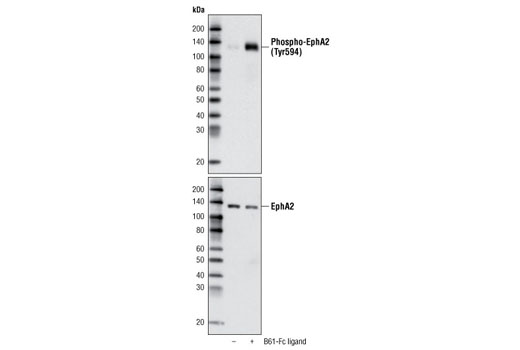 Western Blotting Image 2: Phospho-EphA2 (Tyr594) Antibody