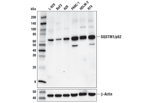  Image 4: p62/KEAP1/NRF2 Pathway Antibody Sampler Kit