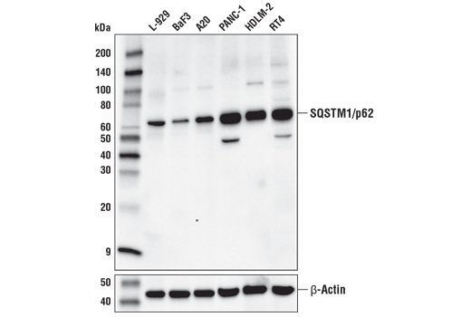 undefined Image 4: p62/KEAP1/NRF2 Pathway Antibody Sampler Kit