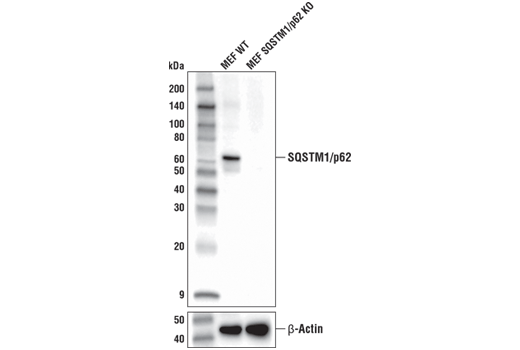  Image 21: p62/KEAP1/NRF2 Pathway Antibody Sampler Kit