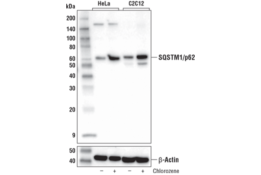  Image 29: p62/KEAP1/NRF2 Pathway Antibody Sampler Kit