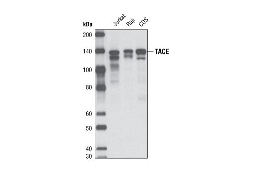 Western Blotting Image 1: TACE Antibody