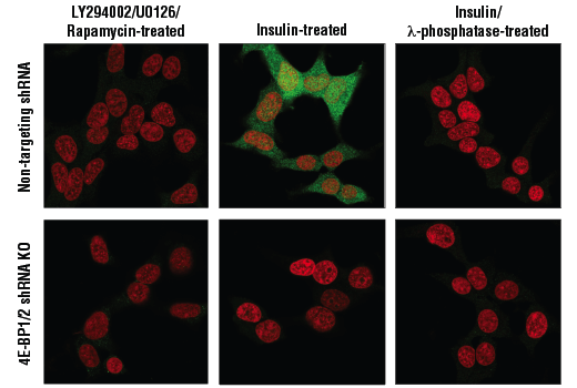 Immunofluorescence Image 1: Phospho-4E-BP1 (Thr37/46) (236B4) Rabbit mAb (BSA and Azide Free)