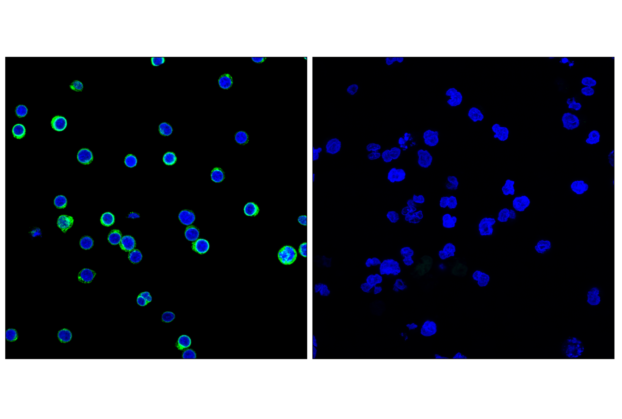 Immunofluorescence Image 2: CD3ε (F2E3X) Rabbit mAb