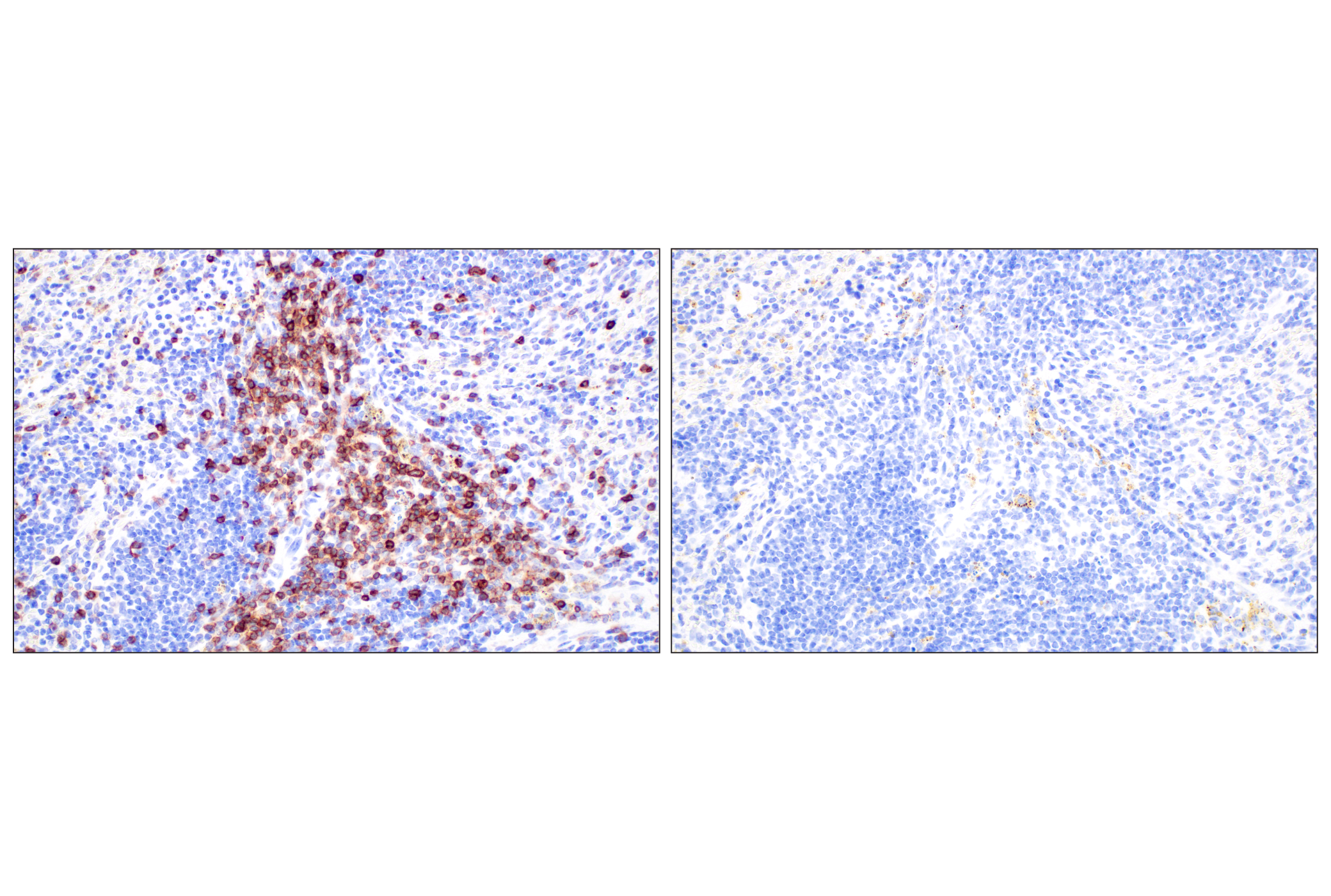 Immunohistochemistry Image 5: CD5 (E6N9S) Rabbit mAb (BSA and Azide Free)