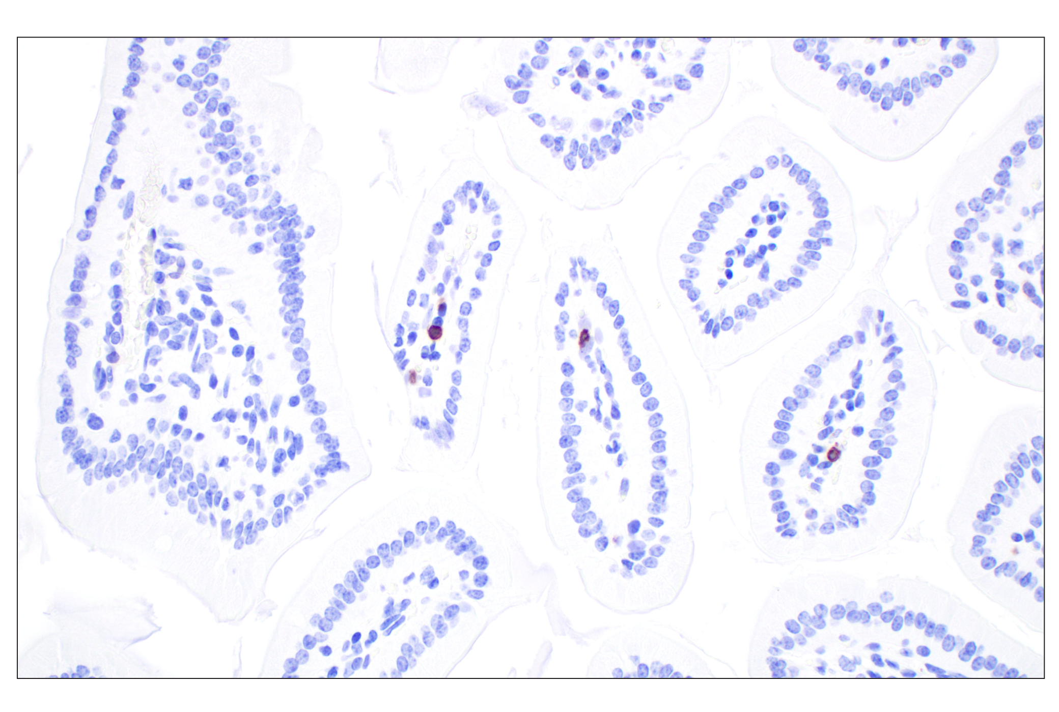 Immunohistochemistry Image 4: CD5 (E6N9S) Rabbit mAb (BSA and Azide Free)