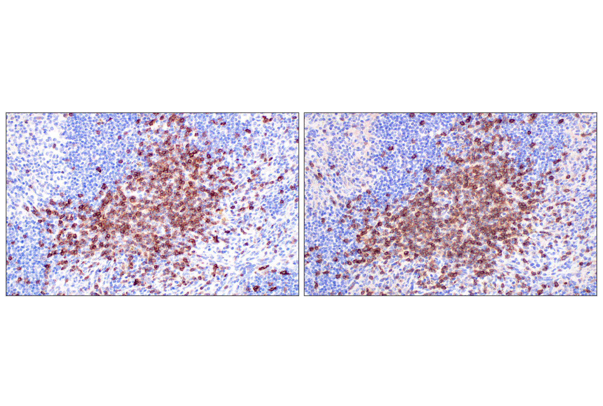 Immunohistochemistry Image 6: CD5 (E6N9S) Rabbit mAb (BSA and Azide Free)