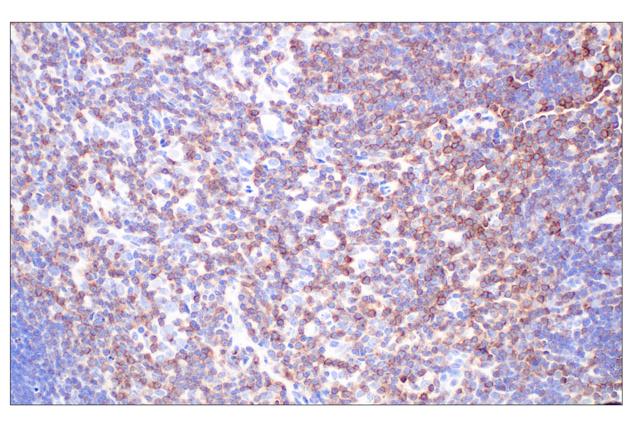 Immunohistochemistry Image 1: CD5 (E6N9S) Rabbit mAb (BSA and Azide Free)
