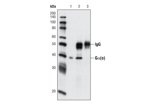 Immunoprecipitation Image 1: Gα(o) Antibody (IP Preferred)