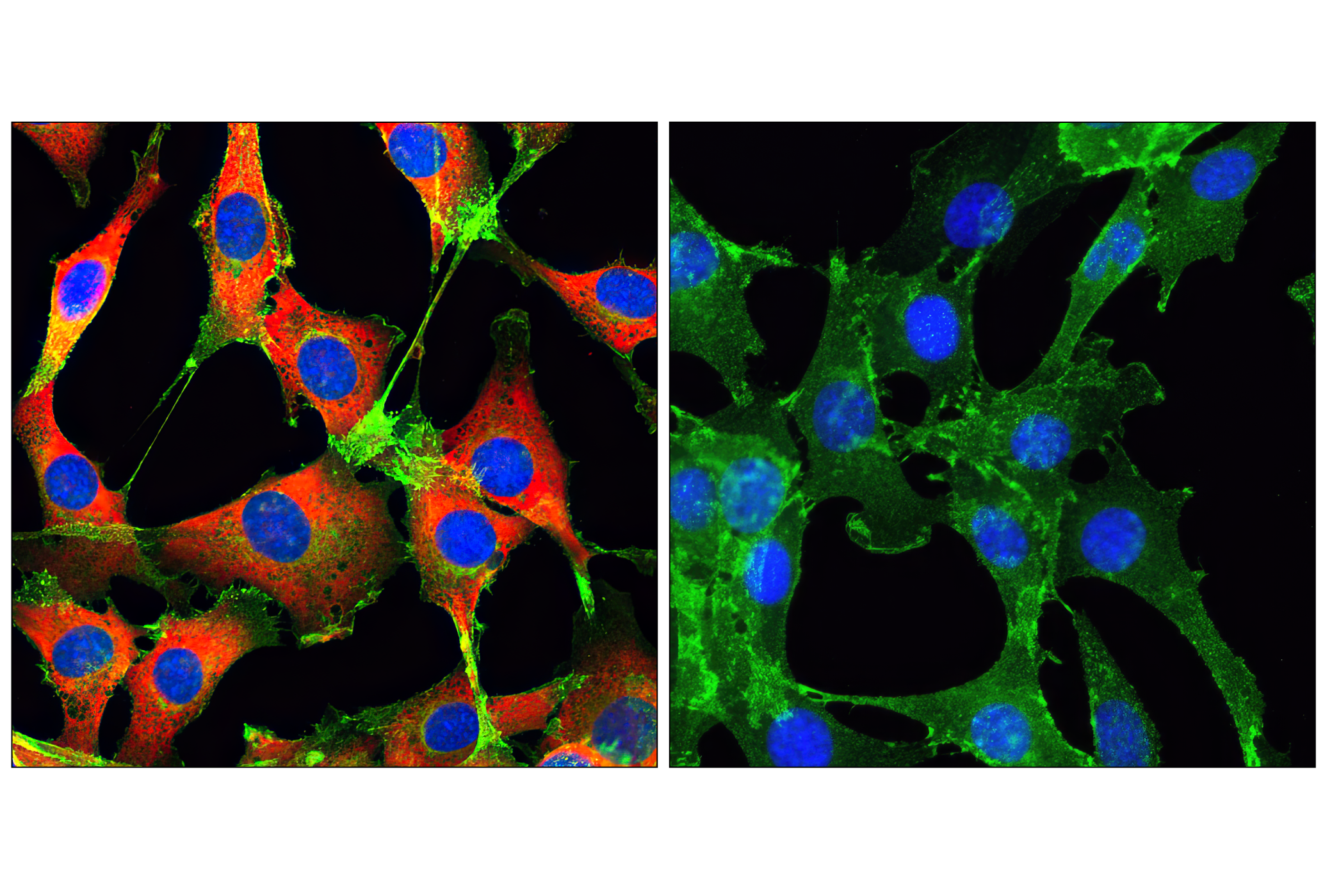 Immunofluorescence Image 1: Phospho-S6 Ribosomal Protein (Ser235/236) (D57.2.2E) XP® Rabbit mAb (Alexa Fluor® 555 Conjugate)