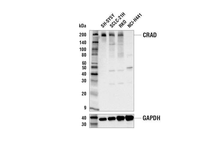 Western Blotting Image 1: CRAD Antibody