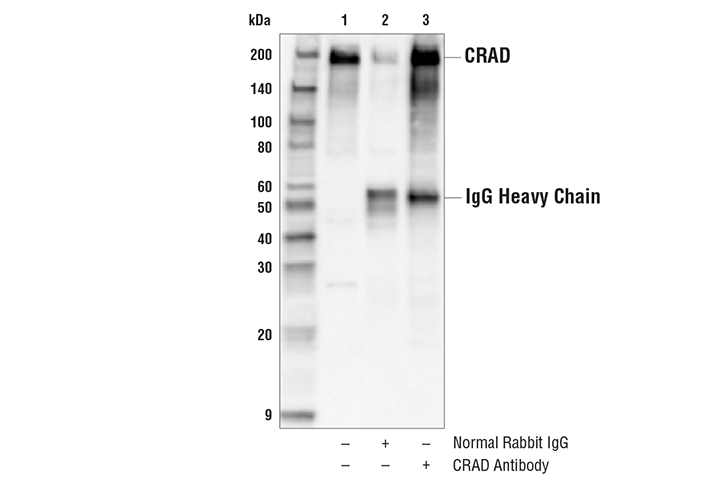 Immunoprecipitation Image 1: CRAD Antibody