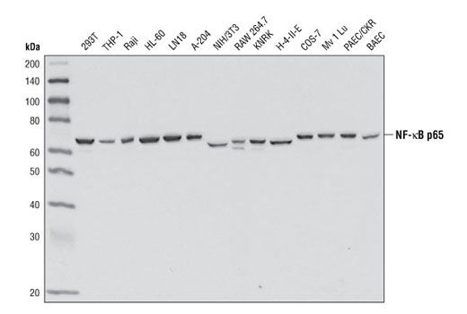 Western Blotting Image 1: NF-κB p65 (E498) Antibody