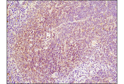 Immunohistochemistry Image 3: NF-κB p65 (E498) Antibody