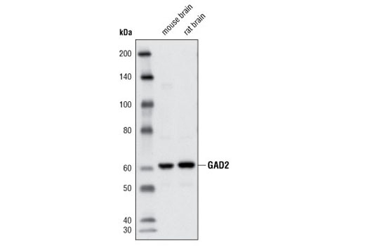 Western Blotting Image 1: GAD2 Antibody