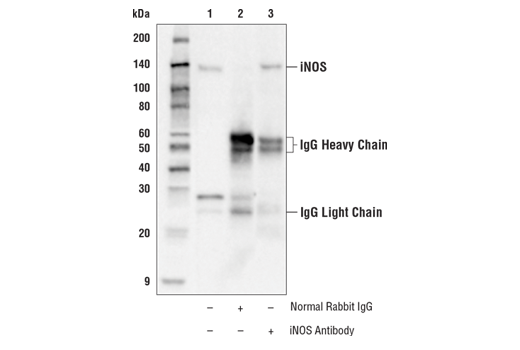 Immunoprecipitation Image 1: iNOS Antibody