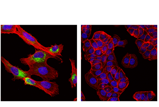 Immunofluorescence Image 1: COL1A1 (E6A8E) Rabbit mAb