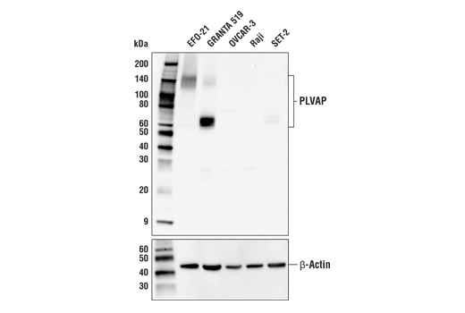 Western Blotting Image 1: PLVAP Antibody (Carboxy-terminal Antigen)