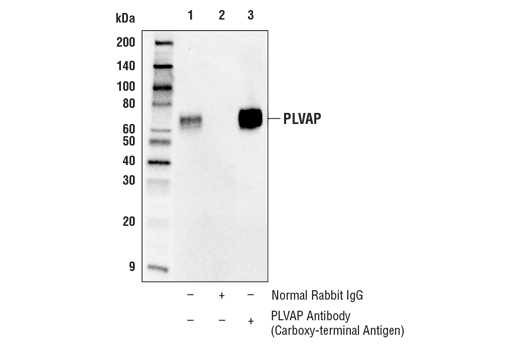 Immunoprecipitation Image 1: PLVAP Antibody (Carboxy-terminal Antigen)