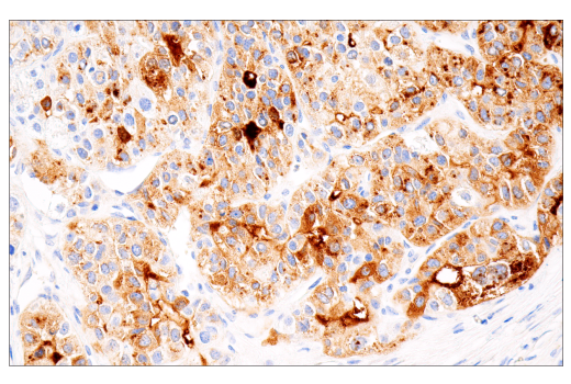 Immunohistochemistry Image 1: AFP (C3) Mouse mAb