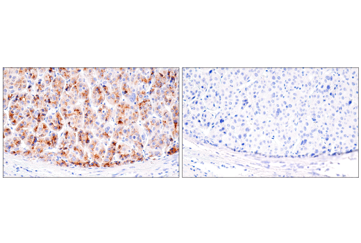 Immunohistochemistry Image 4: AFP (C3) Mouse mAb