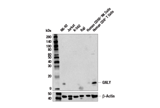Western Blotting Image 1: GNLY (E2T3D) Rabbit mAb (BSA and Azide Free)