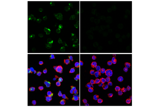 Immunofluorescence Image 1: GNLY (E2T3D) Rabbit mAb (BSA and Azide Free)
