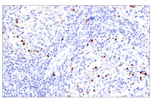 Immunohistochemistry Image 6: GNLY (E2T3D) Rabbit mAb (BSA and Azide Free)