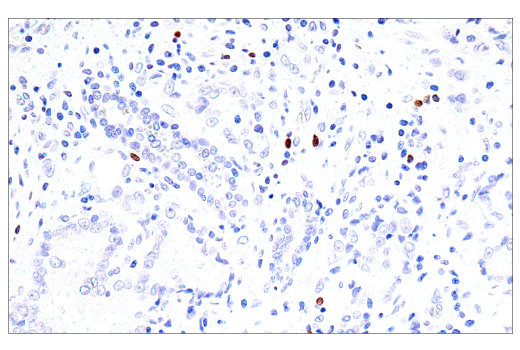 Immunohistochemistry Image 4: GNLY (E2T3D) Rabbit mAb (BSA and Azide Free)