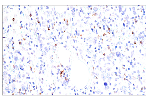 Immunohistochemistry Image 2: GNLY (E2T3D) Rabbit mAb (BSA and Azide Free)