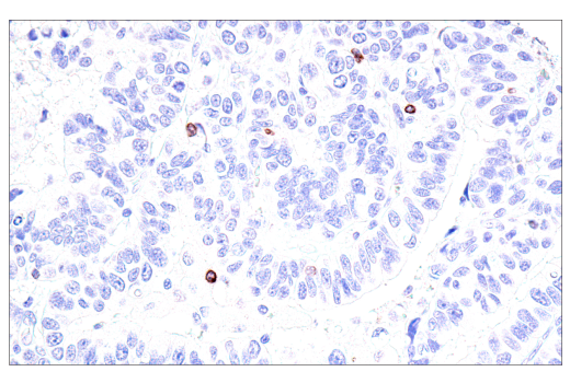 Immunohistochemistry Image 3: GNLY (E2T3D) Rabbit mAb (BSA and Azide Free)