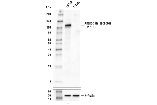 Western Blotting Image 1: Androgen Receptor (D6F11) XP® Rabbit mAb (Biotinylated)