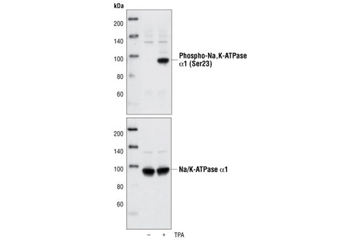 Western Blotting Image 1: Phospho-Na,K-ATPase α1 (Ser23) Antibody