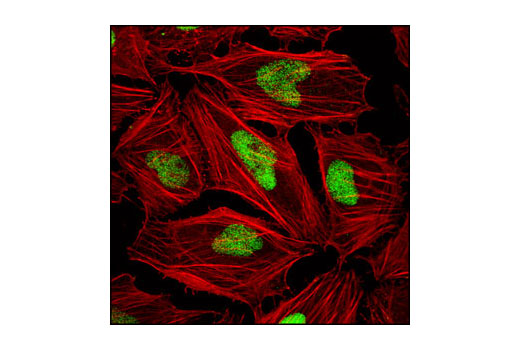 Immunofluorescence Image 1: MCM2 Antibody